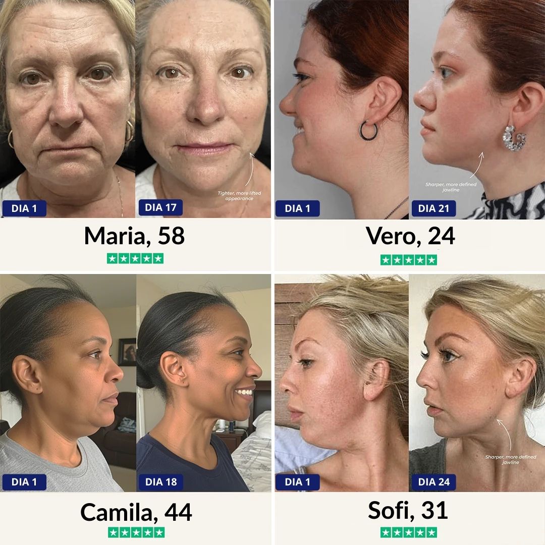 FemmeFine™ Lift: Tu Mejor Contorno Facial